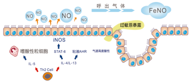 一氧化氮(FeNO)呼氣檢測(cè)在哮喘診斷和管理的應(yīng)用